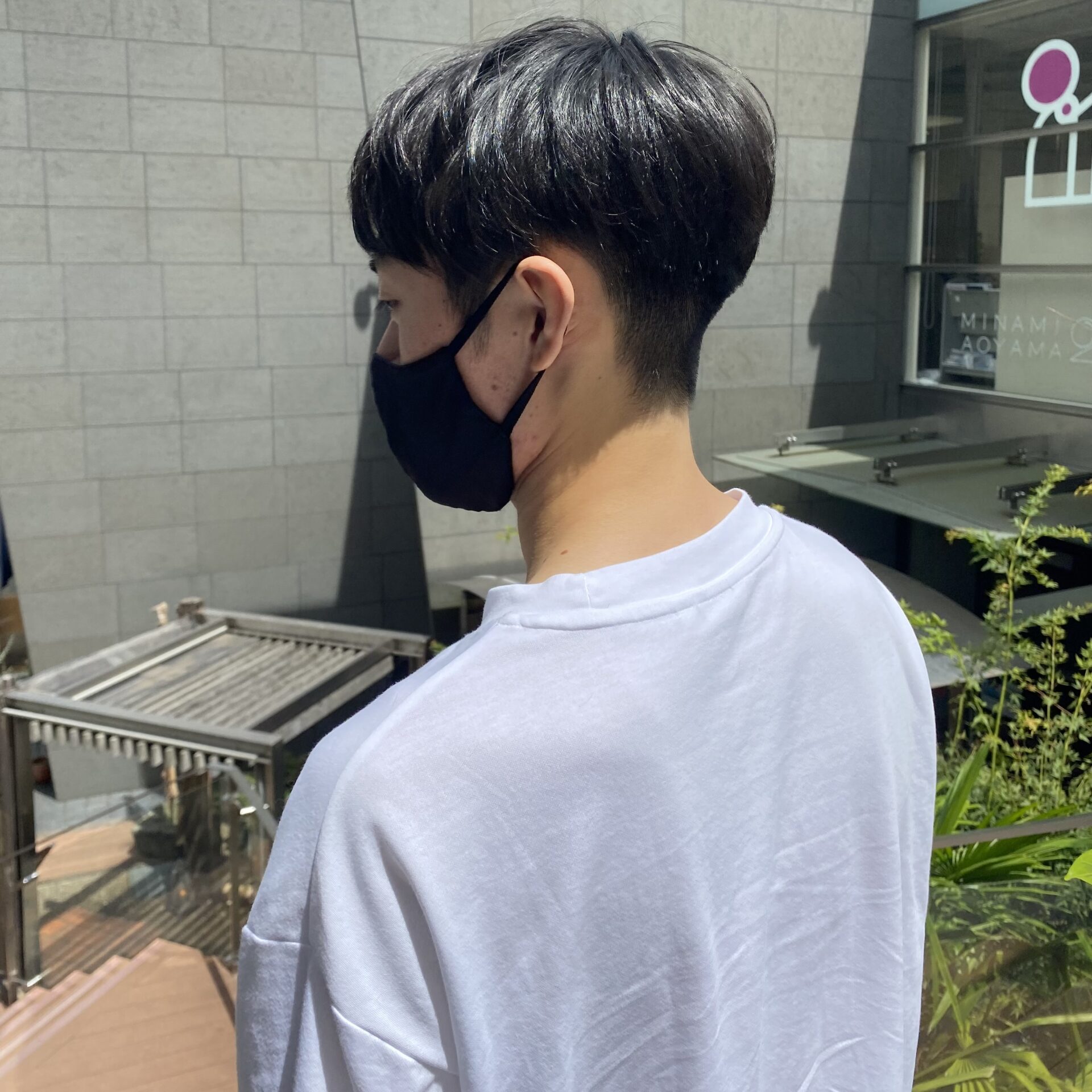 かりあげは整形